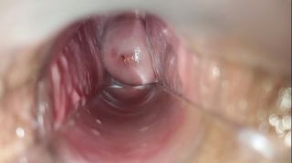 insect inside vagina